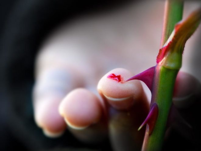 Уколоть палец иголкой, булавкой или шипом розы: значение примет